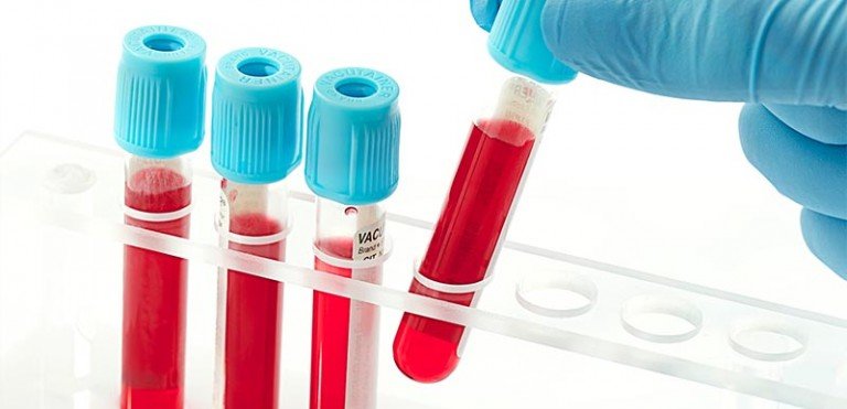 Чем полезен биохимический анализ крови?