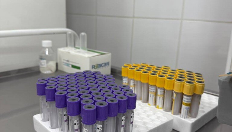 Анализ крови на витамин D