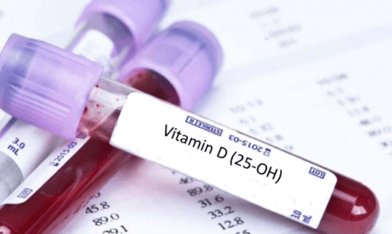 Анализ крови на витамин D со скидкой